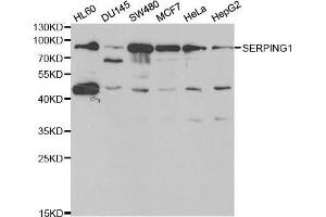 Western blot analysis of extracts of various cell lines, using SERPING1 antibody. (SERPING1 antibody  (AA 201-500))