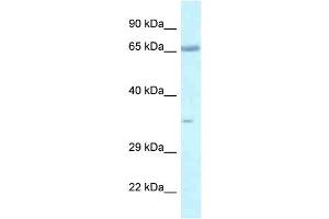 WB Suggested Anti-Lzts1 Antibody   Titration: 1. (LZTS1 antibody  (C-Term))