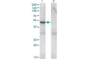 Western Blot analysis of PIP4K2C expression in transfected 293T cell line by PIP4K2C monoclonal antibody (M01A), clone 3A4. (PIP4K2C antibody  (AA 310-381))
