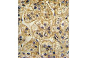 Immunohistochemistry (IHC) image for anti-Adaptor-Related Protein Complex 2, alpha 2 Subunit (AP2A2) antibody (ABIN3003799) (AP2A2 antibody)