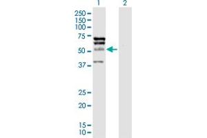 Western Blot analysis of ELK4 expression in transfected 293T cell line by ELK4 MaxPab polyclonal antibody.