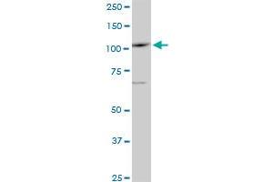 Western Blotting (WB) image for anti-Sal-Like 4 (SALL4) (AA 954-1054) antibody (ABIN466230) (SALL4 antibody  (AA 954-1054))