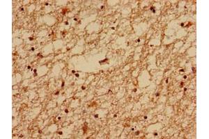 Immunohistochemistry analysis of human brain tissue using ABIN7159132 at dilution of 1:100 (MED24 antibody  (AA 1-300))