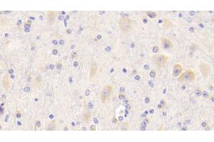Detection of APP in Mouse Cerebellum Tissue using Polyclonal Antibody to Amyloid Precursor Protein (APP)