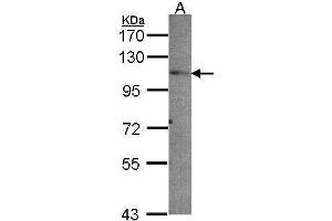 WB Image Sample (30 ug of whole cell lysate) A: A549 7. (PEX6 antibody)