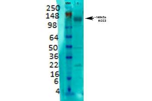 Western Blot analysis of Rat brain membrane lysate showing detection of KCC2 protein using Mouse Anti-KCC2 Monoclonal Antibody, Clone S1-12 . (KCC2 antibody  (AA 932-1043) (FITC))