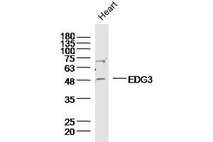 Mouse heart lysates probed with EDG3 Polyclonal Antibody, unconjugated  at 1:300 overnight at 4°C followed by a conjugated secondary antibody at 1:10000 for 90 minutes at 37°C. (S1PR3 antibody  (AA 145-250))