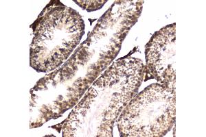 IHC analysis of POLR2A using anti-POLR2A antibody . (POLR2A/RPB1 antibody  (AA 1148-1384))