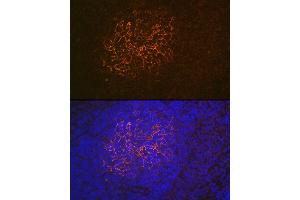 Immunofluorescence analysis of rat spleen using CR2/CD21 Rabbit mAb (ABIN1678995, ABIN3015431, ABIN3015432 and ABIN7101406) at dilution of 1:100 (40x lens). (CD21 antibody)