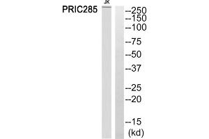 Western blot analysis of extracts from Jurkat cells, using PRIC285 antibody. (HELZ2 antibody  (Internal Region))