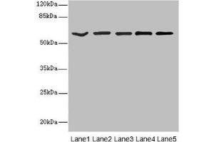 Western blot All lanes: ASIC3 antibody at 2. (ASIC3 antibody  (AA 62-320))