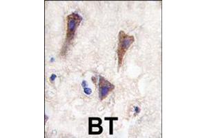 Formalin-fixed and paraffin-embedded human brain tissue reacted with CDH12 antibody , which was peroxidase-conjugated to the secondary antibody, followed by DAB staining. (Cadherin 12 antibody  (N-Term))