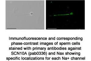 Image no. 1 for anti-Sodium Channel Protein Type X alpha Subunit (SCN10A) (C-Term) antibody (ABIN347335) (Sodium Channel Protein Type X alpha Subunit (SCN10A) (C-Term) antibody)