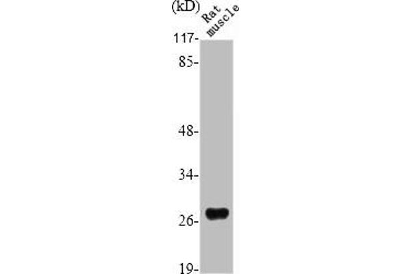 SIX Homeobox 6 antibody  (Internal Region)