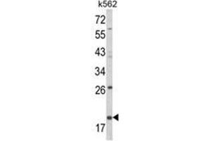 Western blot analysis of KLRD1 Antibody (N-term) in K562 cell line lysates (35ug/lane).
