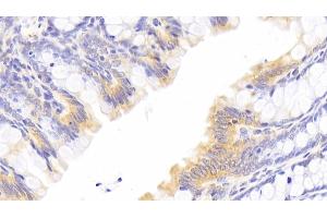 Detection of HMGCR in Rat Colon Tissue using Polyclonal Antibody to 3-Hydroxy-3-Methylglutaryl Coenzyme A Reductase (HMGCR)