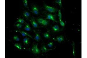 Anti-ATG3 mouse monoclonal antibody (ABIN2454895) immunofluorescent staining of COS7 cells transiently transfected by pCMV6-ENTRY ATG3 (RC203453). (ATG3 antibody)