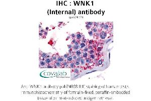 Image no. 1 for anti-WNK Lysine Deficient Protein Kinase 1 (WNK1) (Internal Region) antibody (ABIN1740813) (WNK1 antibody  (Internal Region))