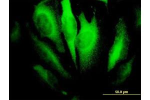 Immunofluorescence of monoclonal antibody to RHOA on HeLa cell. (RHOA antibody  (AA 1-193))