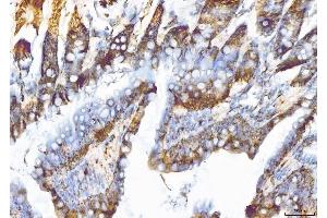 IHC analysis of EIF5A using anti-EIF5A antibody (ABIN7602568). (EIF5A antibody  (AA 86-154))