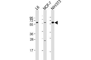 All lanes : Anti-YES1 Antibody (N-term) at 1:2000 dilution Lane 1: L6 whole cell lysates Lane 2: MCF-7 whole cell lysates Lane 3: NIH/3T3 whole cell lysates Lysates/proteins at 20 μg per lane. (YES1 antibody  (N-Term))
