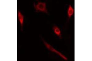 ABIN6274985 staining  HT29 cells by IF/ICC. (CRABP2 antibody  (Internal Region))