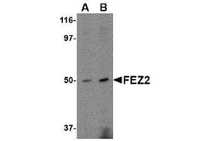 Western blot analysis of FEZ2 in mouse brain tissue lysate with AP30334PU-N FEZ2 antibody at (A) 0. (FEZ2 antibody  (C-Term))