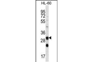 Western blot analysis in HL-60 cell line lysates (35ug/lane). (CA6 antibody  (C-Term))
