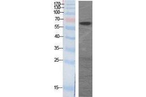 Western Blotting (WB) image for anti-GAD65+GAD67 (C-Term) antibody (ABIN3175202) (GAD65+GAD67 (C-Term) antibody)