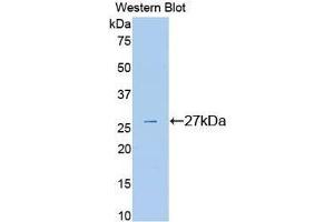 Western Blotting (WB) image for anti-Plasminogen (PLG) (AA 582-812) antibody (ABIN3207025)