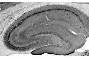 Adult rat hippocampus immunohistochemistry. (Neuroligin 1 antibody  (C-Term, Intracellular))