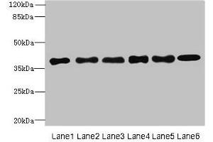 Western blot All lanes: TMEM68 antibody at 4 μg/mL Lane 1: Mouse thymus tissue Lane 2: K562 whole cell lysate Lane 3: U251 whole cell lysate Lane 4: HepG2 whole cell lysate Lane 5: MCF-7 whole cell lysate Lane 6: Jurkat whole cell lysate Secondary Goat polyclonal to rabbit IgG at 1/10000 dilution Predicted band size: 38, 30, 16 kDa Observed band size: 38 kDa (TMEM68 antibody  (AA 74-114))
