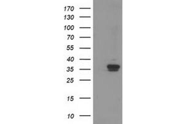 RDH14 antibody
