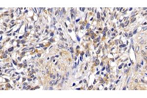 Immunohistochemistry (IHC) image for anti-BCL2-Associated Agonist of Cell Death (BAD) (AA 1-168) antibody (ABIN7443224)