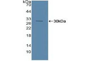 Detection of Recombinant ASM, Human using Polyclonal Antibody to Acid Sphingomyelinase (ASM) (SMPD1 antibody  (AA 319-579))