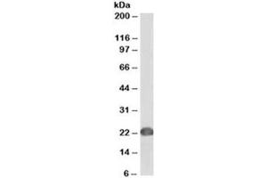 Western blot testing of human Jurkat lysate with biotinylated DJ-1 antibody at 0. (PARK7/DJ1 antibody  (Biotin))