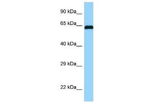 WB Suggested Anti-ABI1 Antibody Titration: 1. (ABI1 antibody  (N-Term))