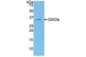 Detection of Recombinant PKCh, Human using Polyclonal Antibody to Protein Kinase C Eta (PKCh) (PKC eta antibody  (AA 355-614))