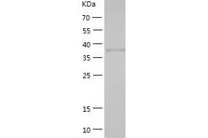 Western Blotting (WB) image for Napsin A Aspartic Peptidase (NAPSA) (AA 64-420) protein (His tag) (ABIN7124112) (NAPSA Protein (AA 64-420) (His tag))