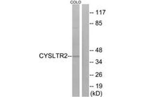 Western Blotting (WB) image for anti-Cysteinyl Leukotriene Receptor 2 (CYSLTR2) (AA 281-330) antibody (ABIN2890761) (CasLTR2 antibody  (AA 281-330))