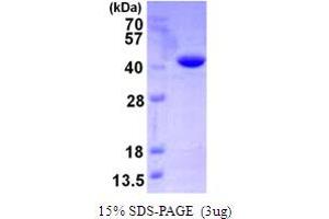SDS-PAGE (SDS) image for Vps20-Associated 1 Homolog (VTA1) (AA 1-307) protein (His tag) (ABIN667681) (VTA1 Protein (AA 1-307) (His tag))
