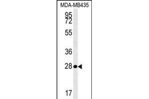 MRM1 Antibody (N-term) (ABIN654341 and ABIN2844111) western blot analysis in MDA-M cell line lysates (35 μg/lane). (MRM1 antibody  (N-Term))
