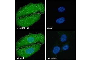(ABIN768598) Immunofluorescence analysis of paraformaldehyde fixed U2OS cells, permeabilized with 0. (GPR183 antibody  (Internal Region))