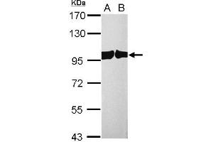 WB Image CSE1L antibody detects CSE1L protein by western blot analysis. (Exportin 2 antibody  (Center))
