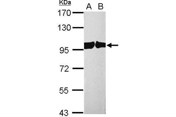 Exportin 2 Antikörper  (Center)