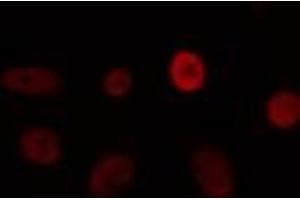 ABIN6274463 staining COLO205 cells by IF/ICC.