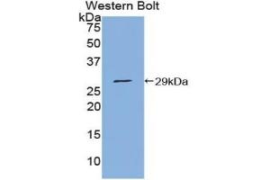 Detection of Recombinant PIAS1, Human using Polyclonal Antibody to Protein Inhibitor Of Activated STAT 1 (PIAS1) (PIAS1 antibody  (AA 409-645))