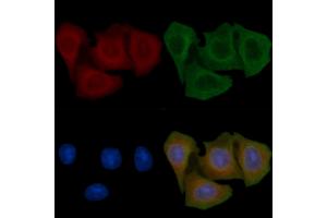 ABIN6257806 and ABIN6275277 staining Hela cells(45 min of heat-shock) by IF/ICC.
