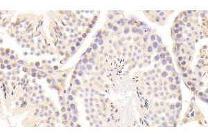 Detection of GAS6 in Mouse Testis Tissue using Polyclonal Antibody to Growth Arrest Specific Protein 6 (GAS6) (GAS6 antibody  (AA 483-646))