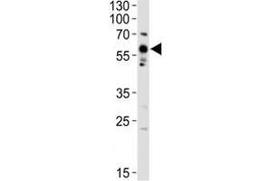 Western blot analysis of lysate from A375 cell line using Src antibody diluted at 1:1000.